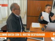 Violencia escolar en Trujillo: alumno queda con el rostro desfigurado tras agresión