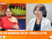 “Es fundamental tomar medidas preventivas porque la radiación afecta directamente las células de la piel”: Jenny Valverde, vocera Círculo Dermatológico Del Perú