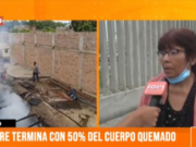 Cartavio: hombre resulta con el 50 % del cuerpo quemado tras ayudar en incendio a su vecina