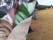 La Libertad: reportan intoxicación masiva en agroindustrial cerca de Paiján