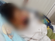 Trujillo: padre pide traslado urgente de su niño con tumor a Lima