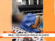 Trujillo: niño de 11 años con riesgo de perder pie tras accidente