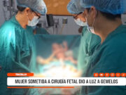 La Libertad: mujer sometida a cirugía fetal dio a luz a gemelos
