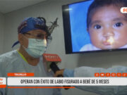 Trujillo: operan con éxito de labio fisurado a bebé de cinco meses