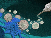 Internacional: inmunoterapia podría mejorar la supervivencia en cáncer de páncreas y colon