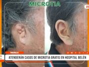 Trujillo: atenderán microtia gratis en hospital Belén