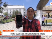 Chiclayo: joven tiktoker pide ayuda para cirugía urgente