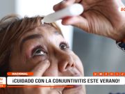 Nacional: conjuntivitis aumenta en verano y alertan por riesgos