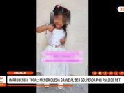Trujillo: Imprudencia vial deja grave a niña de 4 años
