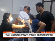 Trujillo: Detectan 7 casos sospechosos de cáncer de piel
