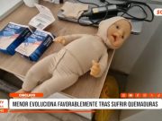 Lambayeque: menor evoluciona favorablemente tras sufrir quemaduras