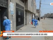 Lambayeque: reportan primer caso de sarampión en niña de dos años