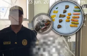 Trujillo: Operan de emergencia a mujer y descubren 10 paquetes de droga en su interior