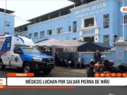 Trujillo: médicos luchan por salvar pierna de niño