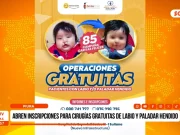 Piura: abren inscripciones para cirugías gratuitas de labio y paladar hendido