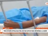 Chiclayo: piden atención especializada para joven que sufre rara enfermedad a la sangre