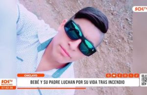 Chiclayo: padre y su bebé luchan por su vida tras sufrir quemadura en incendio