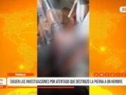 Guadalupe: siguen las investigaciones por atentado que destrozó la pierna a un hombre